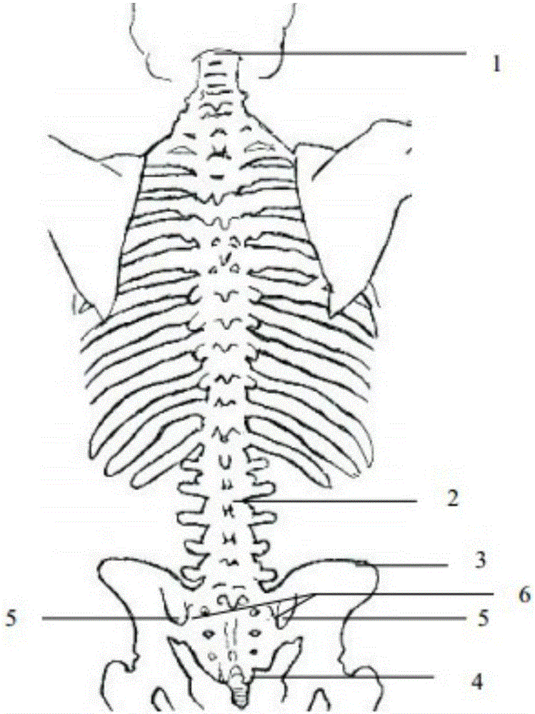 一种脊柱腰椎间隙定位方法与流程