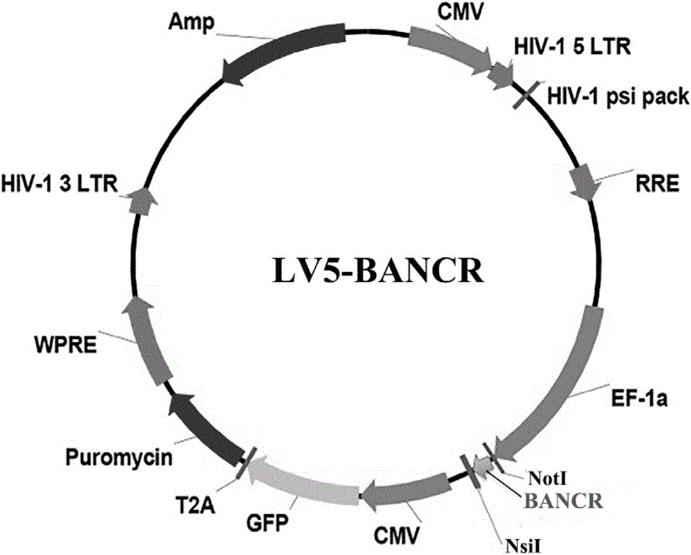 BANCR基因過表達(dá)慢病毒載體、BANCR慢病毒及構(gòu)建方法和應(yīng)用與流程