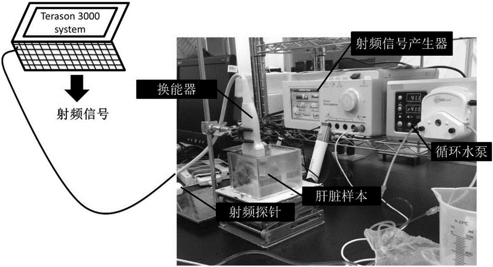 窗口調(diào)制結(jié)合高斯多項式擬合監(jiān)測射頻消融設(shè)備及方法與流程