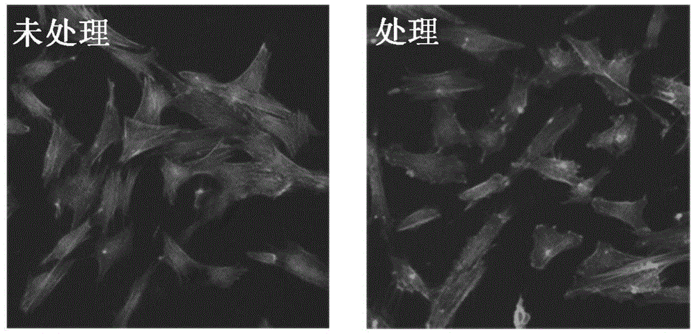 一種可用于糖尿病患者的牙種植體的制備方法與流程