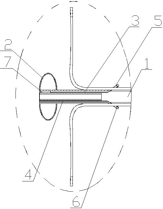 肛门及肛周创面负压引流套件的制作方法与工艺