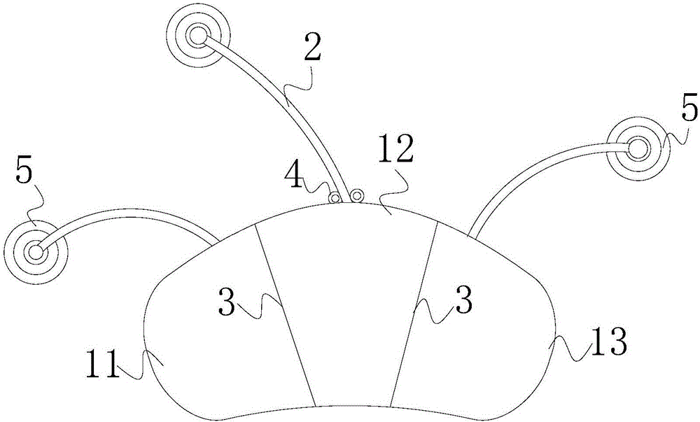 一种扩张器的制作方法与工艺