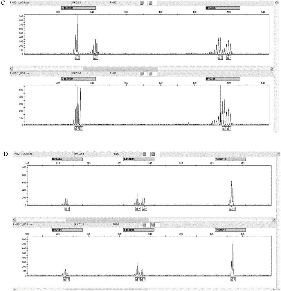 PKD2基因的STR位点及其应用的制作方法与工艺