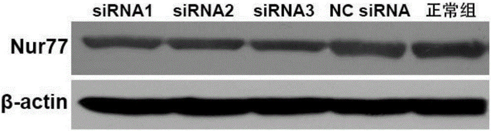 抑制Nur77的siRNA分子及其抗血管再狭窄的应用的制作方法与工艺