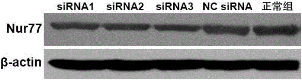 抑制Nur77的siRNA分子及其抗血管再狹窄的應用的制作方法與工藝