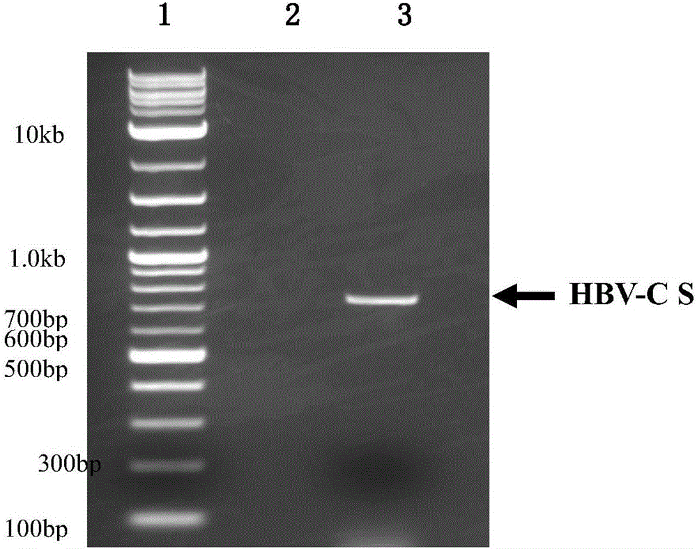 攜帶人C基因型乙型肝炎病毒的表面抗原S基因的重組腺相關病毒載體及其構建方法與應用與流程