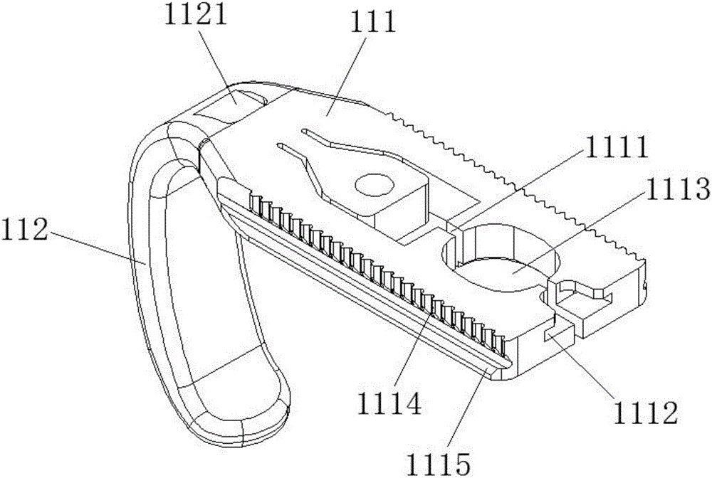 一种易拆型胸骨合拢固定器套件的制作方法与工艺