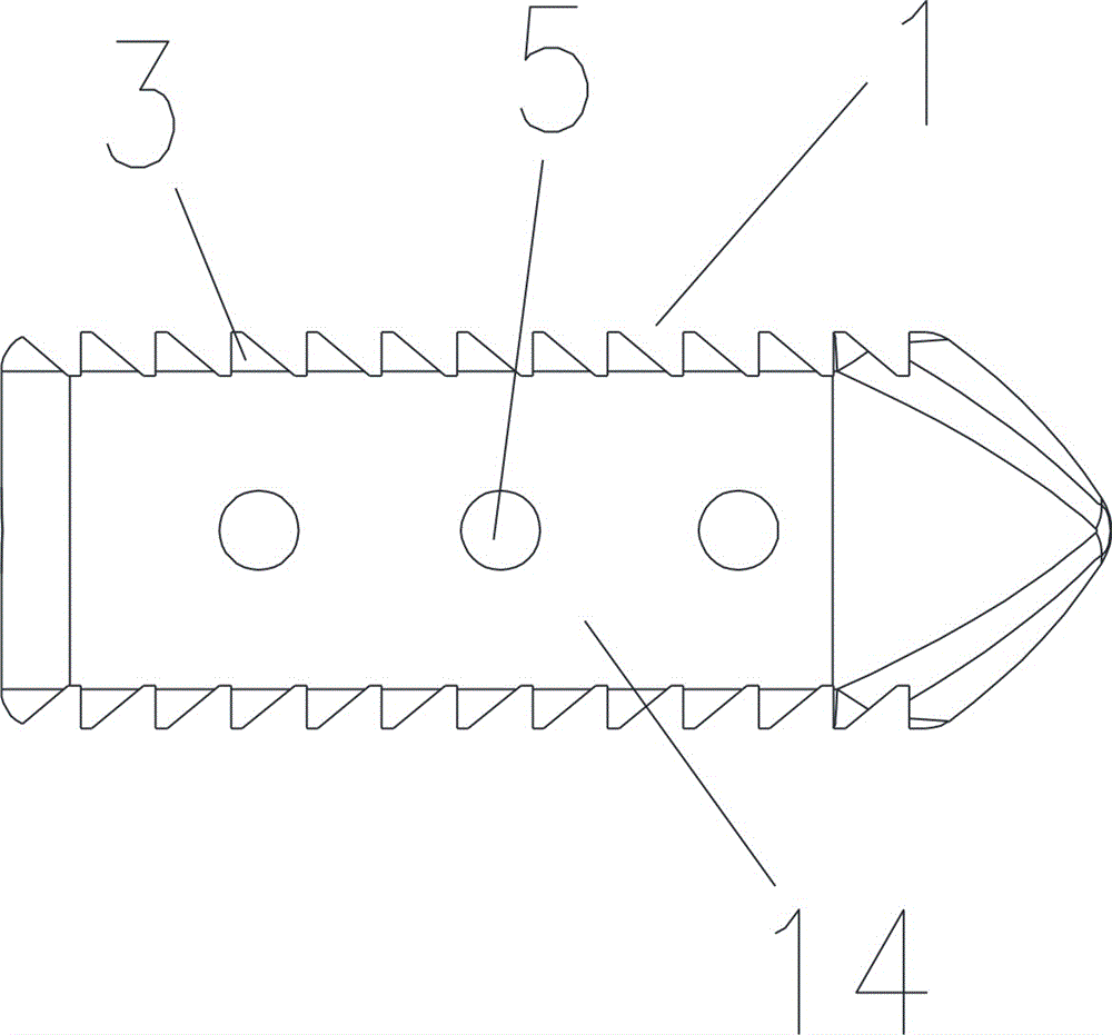 侧路腰椎间融合器的制作方法与工艺