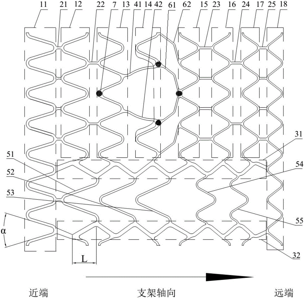 一种适用于分叉血管主支的锥形血管支架的制作方法与工艺