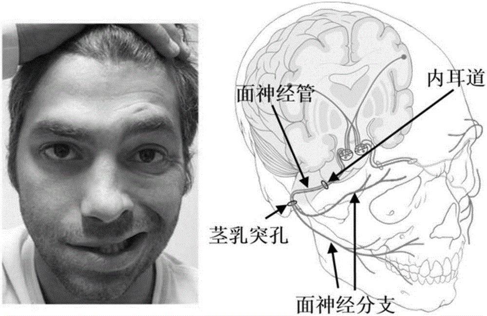 基于用户行为反馈的面部自适应刺激系统及方法与流程