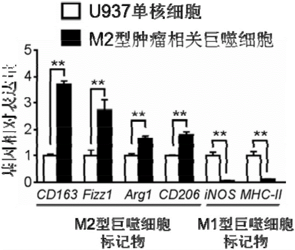 一種M2型腫瘤相關(guān)巨噬細(xì)胞模型的構(gòu)建方法及應(yīng)用與流程