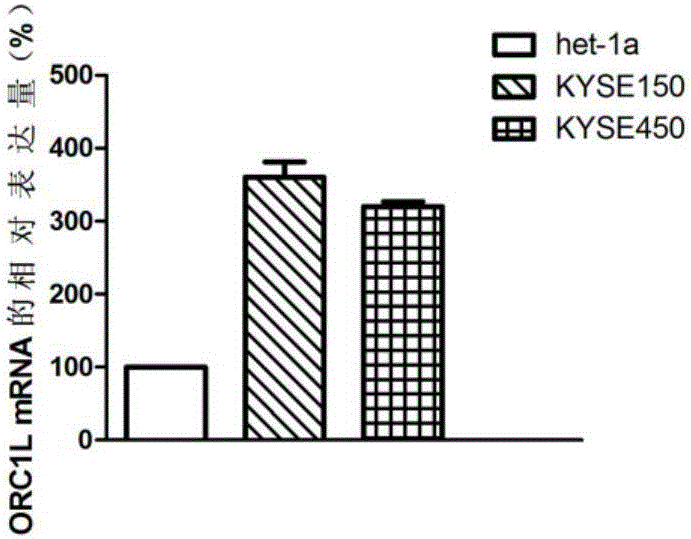 ORC1L基因及其表達(dá)產(chǎn)物在疾病診治中的應(yīng)用的制作方法與工藝