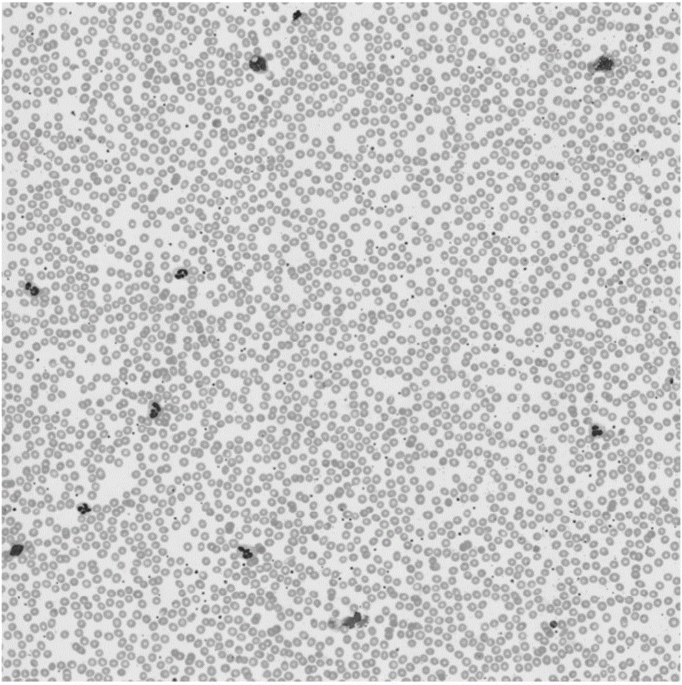 一种基于深度学习的白细胞五分类方法与流程