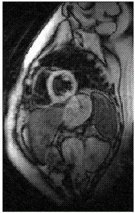 使用黑?血磁共振數(shù)據(jù)探測心肌鐵含量的設(shè)備與方法與流程