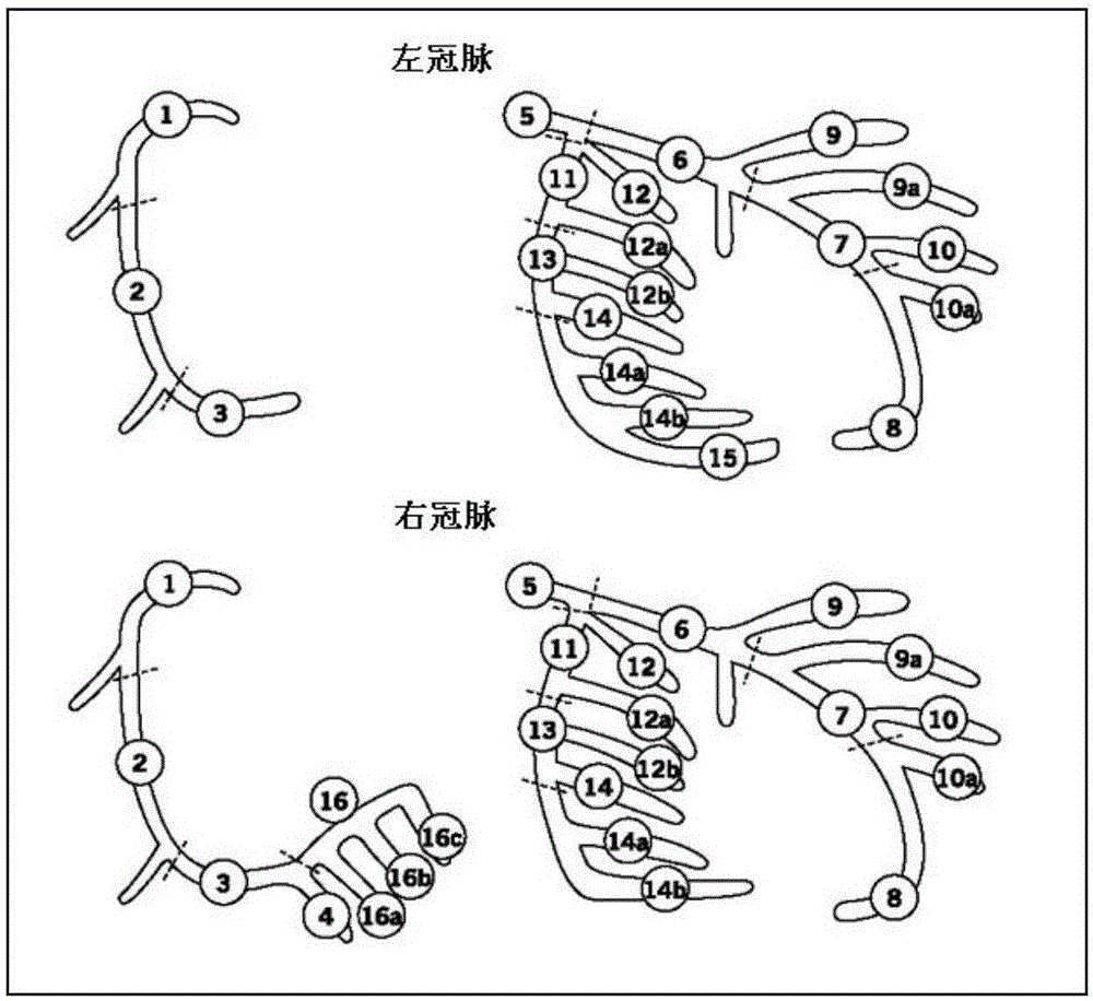 一種CT圖像處理方法及裝置與流程