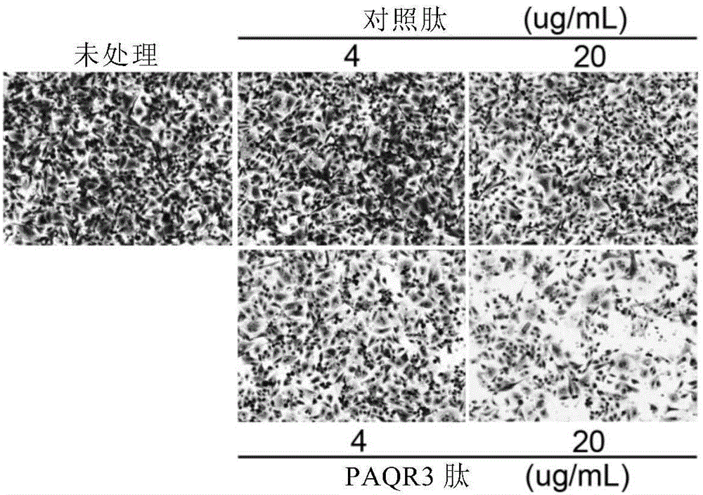 PAQR3多肽片段、其药物组合物及用途的制作方法与工艺