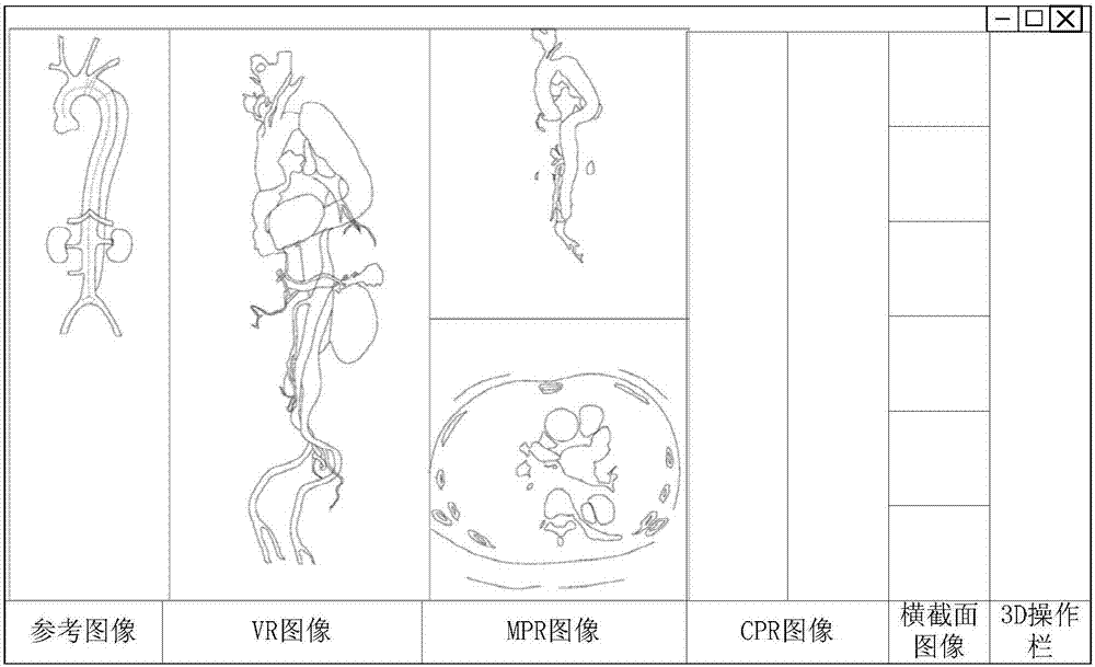 主动脉检测方法、装置、存储介质和处理器与流程