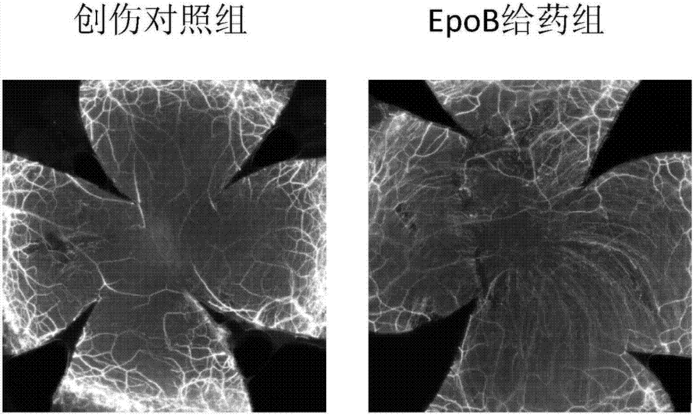 化合物埃博霉素B在制備修復(fù)角膜神經(jīng)創(chuàng)傷的藥物中的應(yīng)用的制作方法與工藝