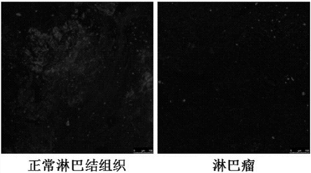 一种基于组织自荧光强度减少作为检测恶性实体瘤标志的检测方法及其应用与流程