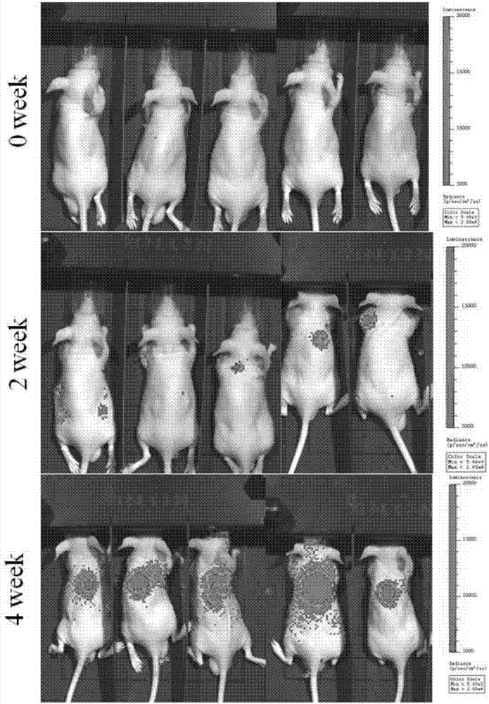 發生上皮間質化的循環腫瘤干細胞在肺癌增殖、耐藥及轉移疾病中的應用的制作方法與工藝