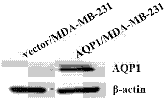 AQP1過表達(dá)質(zhì)粒及其在影響乳腺癌細(xì)胞耐藥性上的用途的制作方法與工藝