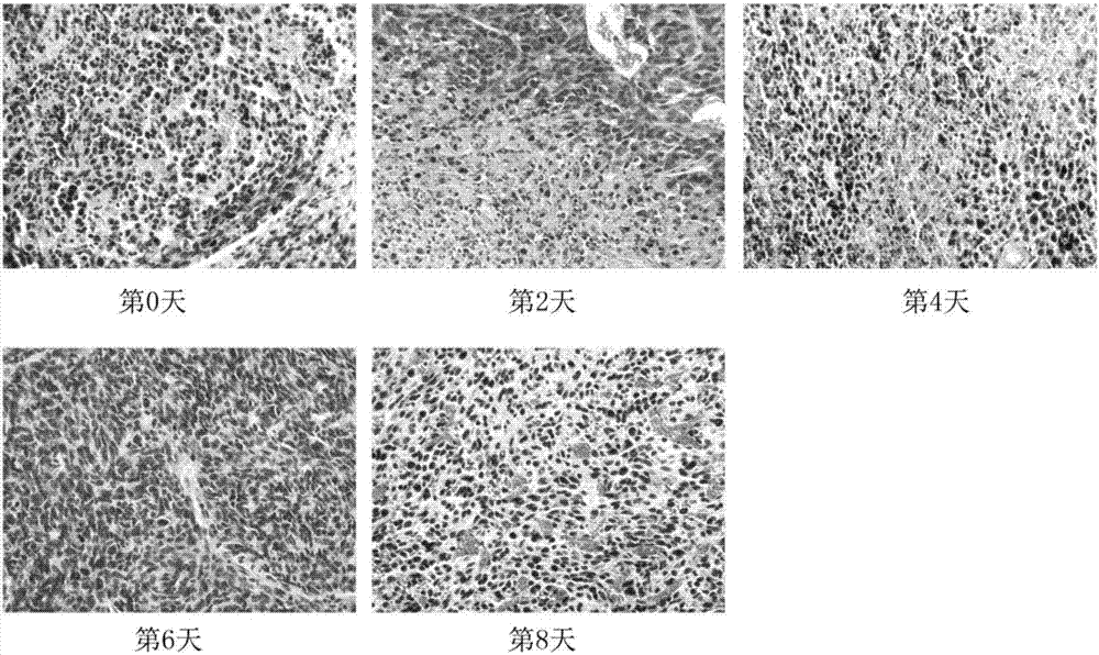 CXCL4單抗治療腫瘤及化療后腫瘤加速再增殖基因篩選法的制作方法與工藝