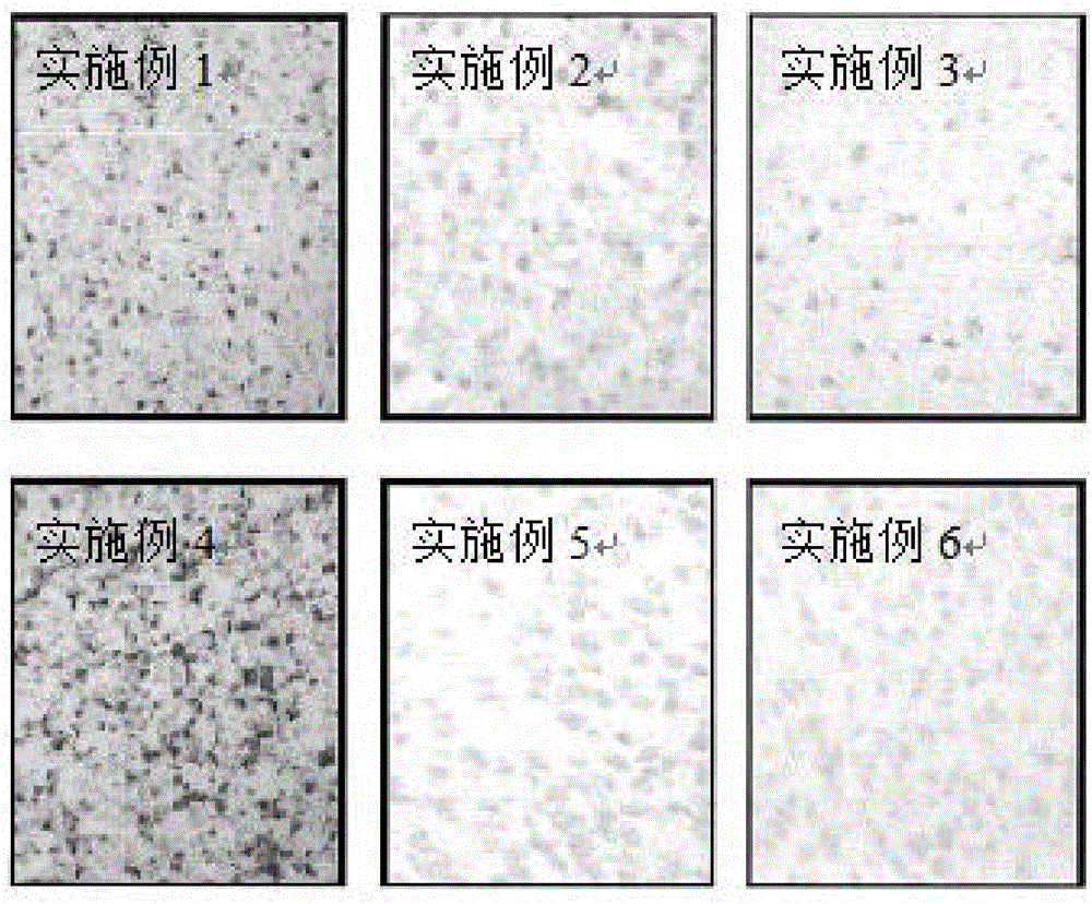 一种能提高填充性脂肪存活率，降低脂肪纤维化钙化的复活素配方的制作方法与工艺