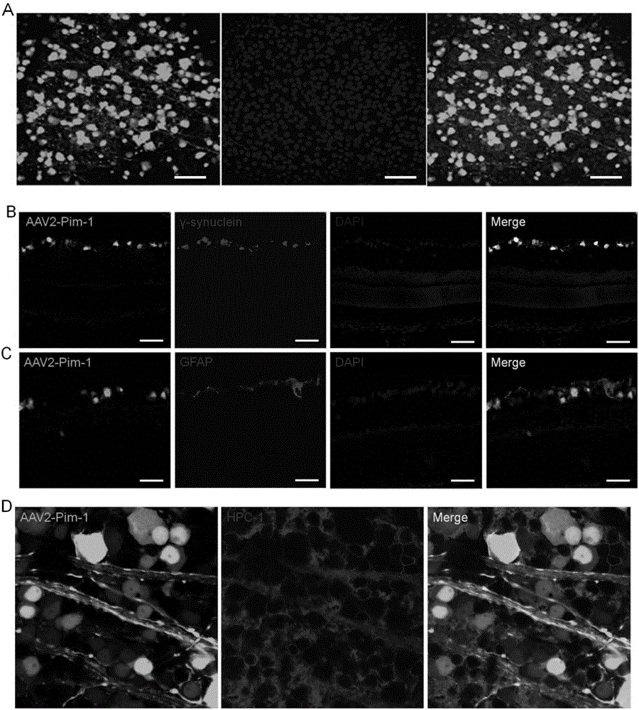 一種攜帶Pim?1基因的腺相關(guān)病毒2及其在修復(fù)受損視神經(jīng)中的應(yīng)用的制作方法與工藝