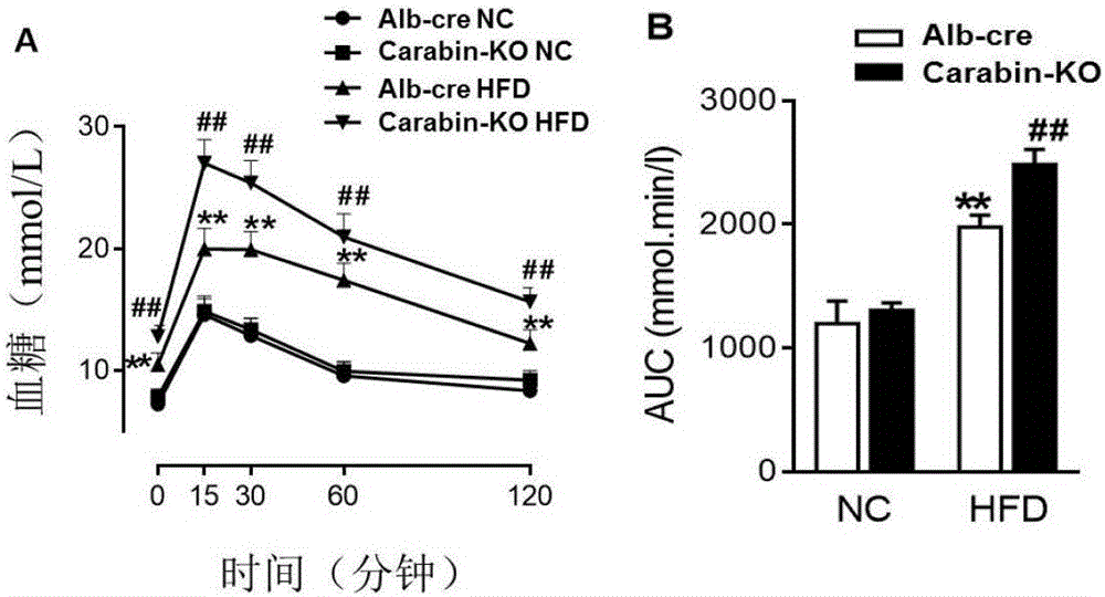 Carabin在治疗脂肪肝和Ⅱ型糖尿病中的功能和应用的制作方法与工艺