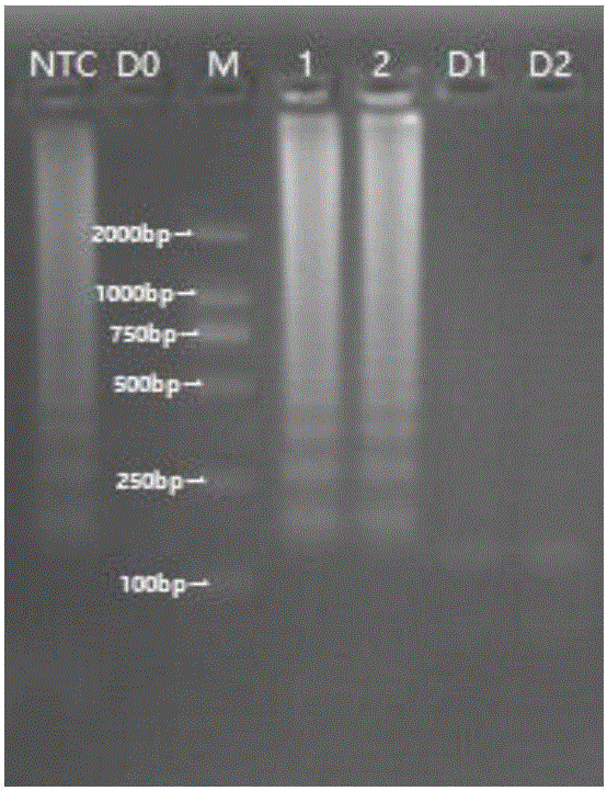 一种嗜肺军团菌dotA基因的LAMP引物组及其试剂盒和应用的制作方法与工艺