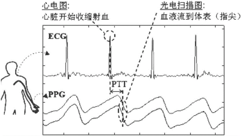 一種人體心電R波檢測系統(tǒng)的制作方法與工藝