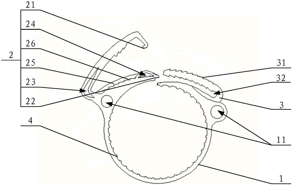 大動(dòng)脈用吻合扣環(huán)及應(yīng)用其的人工血管組件的制作方法與工藝