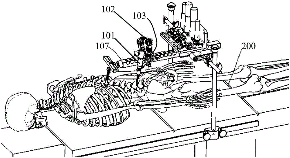 骨質(zhì)磨削機(jī)器人、椎板磨削手術(shù)機(jī)器人控制系統(tǒng)及方法與流程
