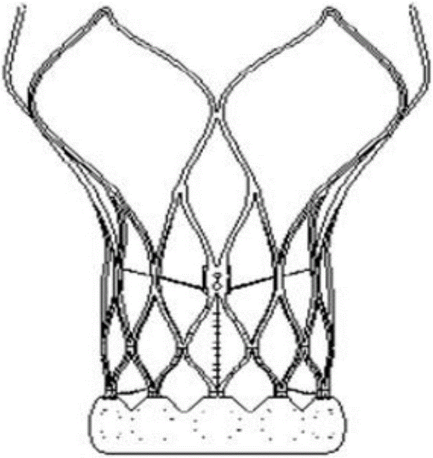 主動(dòng)脈介入瓣制造方法與流程