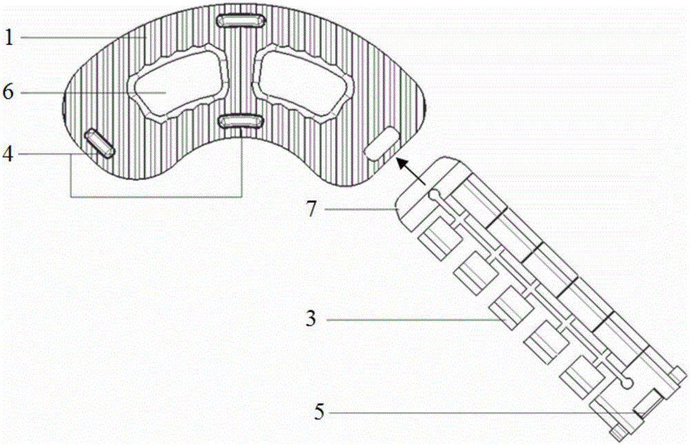 楔入式可调节椎间固定融合器的制作方法与工艺