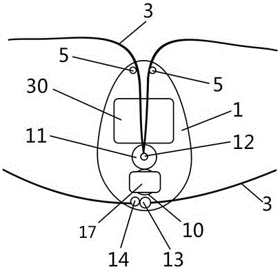 一種智能姿勢矯正帶的制作方法與工藝