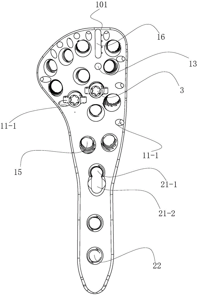 肱骨近端解剖型钢板的制作方法与工艺