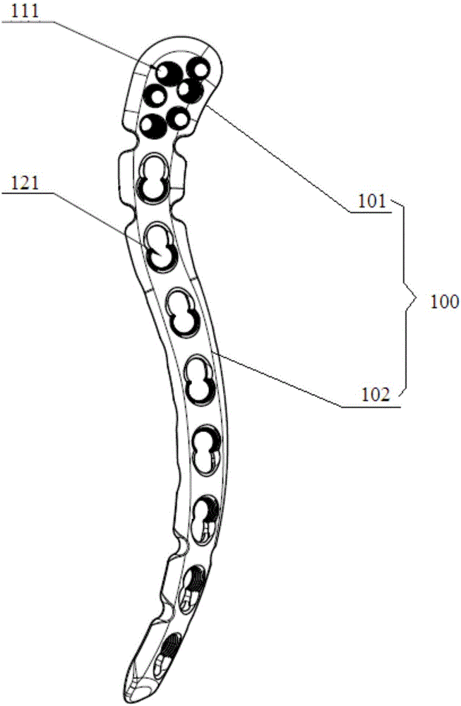 一种贴膜式解剖型锁骨接骨板的制作方法与流程