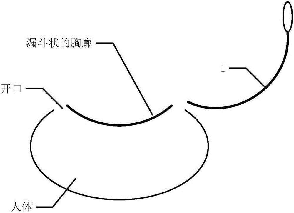 矯形板、矯形器械和外科手術工具的制作方法與工藝