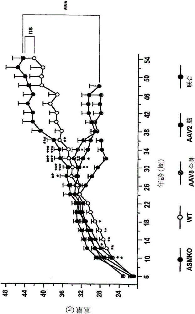 A型尼曼‑皮克病的基因治疗的制作方法与工艺