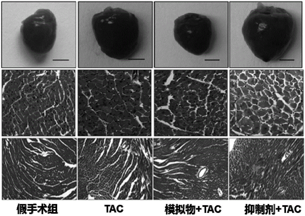 miR‑378抑制心肌肥厚和心肌纤维化并诊断心力衰竭的用途的制作方法与工艺