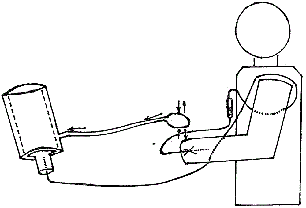 靈活方便高效安全的吊水器的制作方法與工藝