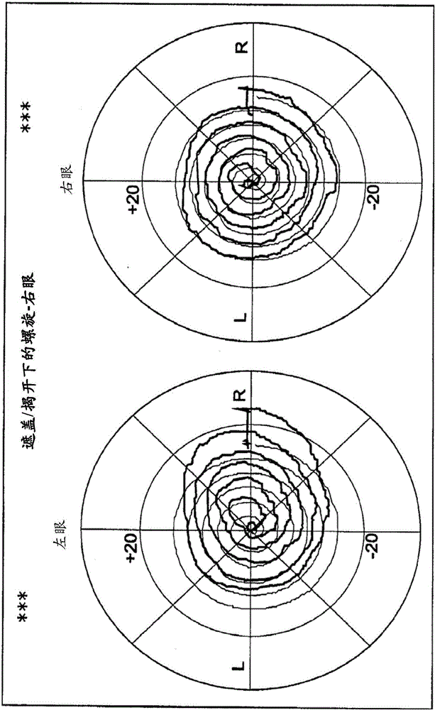 用于测量眼球运动和瞳孔反应的系统、方法和设备与流程