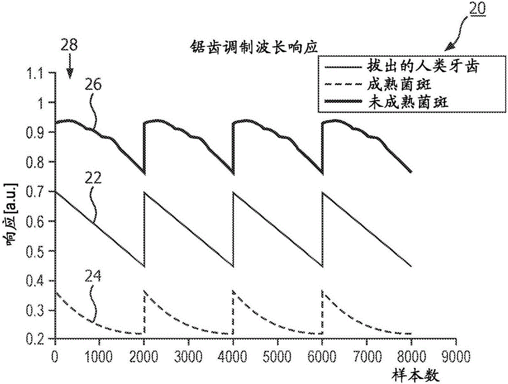 用于菌斑检测的设备和方法与流程