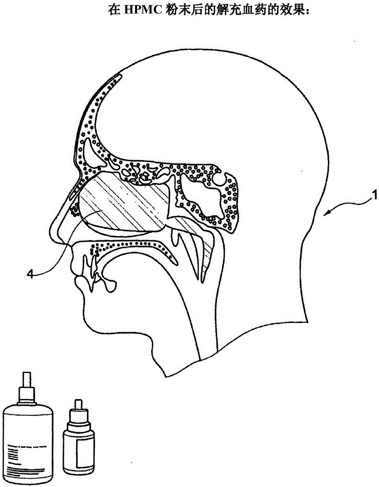 鼻用組合物的改進(jìn)及其使用方法與流程