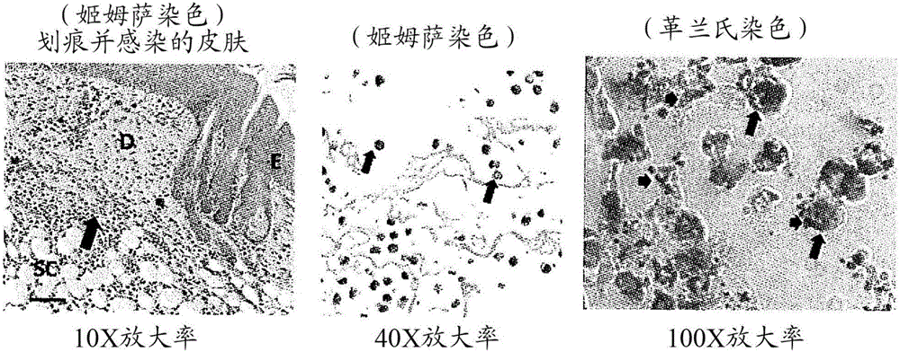 A群鏈球菌疫苗的制作方法與工藝