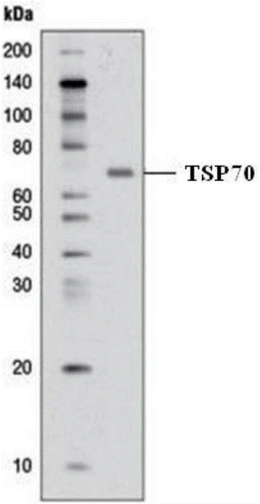 一種腫瘤特異性抗原TSP70及其應(yīng)用的制作方法與工藝