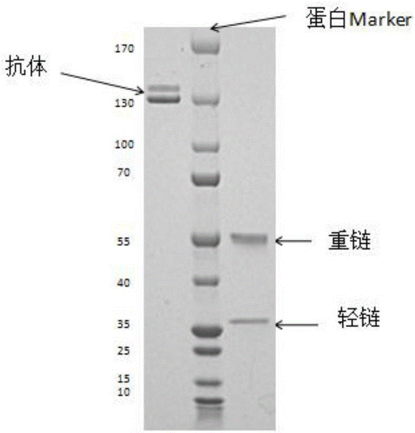 全人源化抗狂犬病毒的中和性抗体的制作方法与工艺