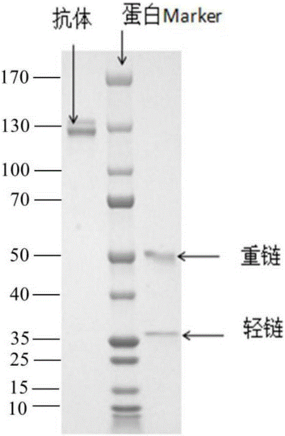 全人源抗狂犬病毒中和抗體及其用途的制作方法與工藝