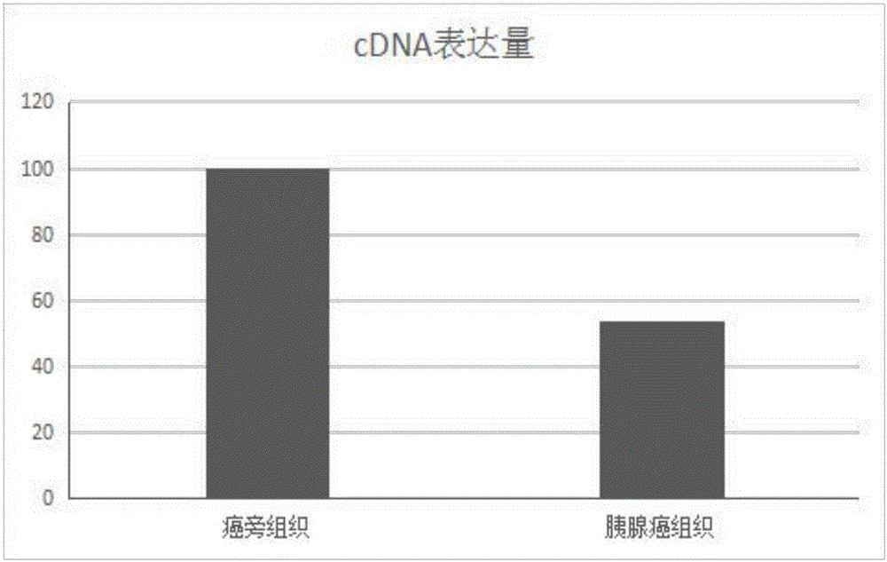 CCDC168作為標記物在檢測胰腺癌試劑中的應(yīng)用的制作方法與工藝